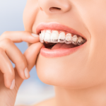 Best Dental Hospital in Hyderabad | Dental Clinic in Hyderabad
