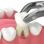 Massapequa Dentist: Modern Dentistry for Healthy Smiles